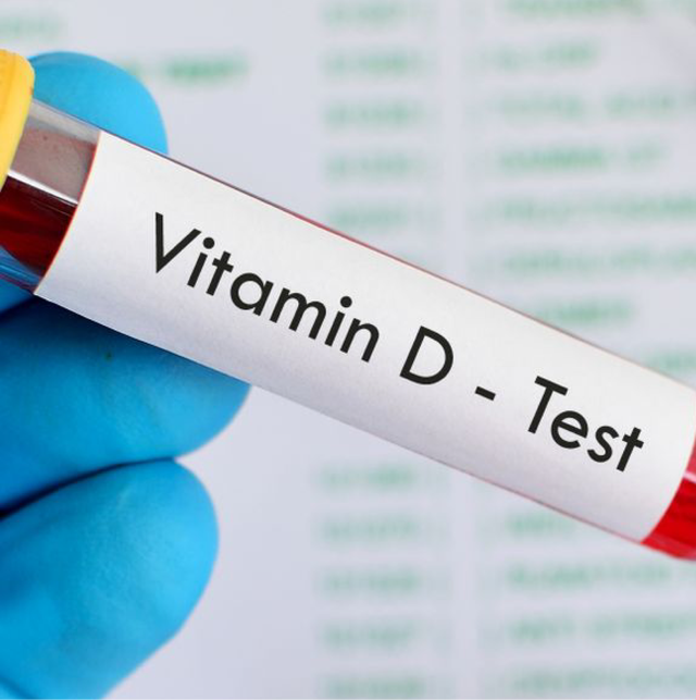 Vitamin D3 Test