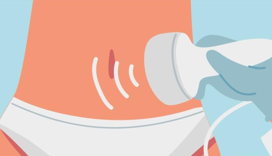 la mésothérapie virtuelle pour le corps casse les cellules graisseuses , gomme la cellulite
reservez votre séance 
medecinedoucemontpellier.fr