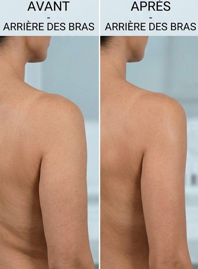 Soin fermeté des bras à Baillargues
massagebaillargues.fr
Réservez votre créneau horaire sur le site