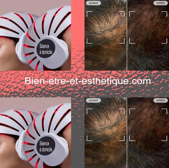 Séance led à domicile
Booster votre système capillaire
Prenez soin de vos cheveux
bien-etre-et-esthetique.com