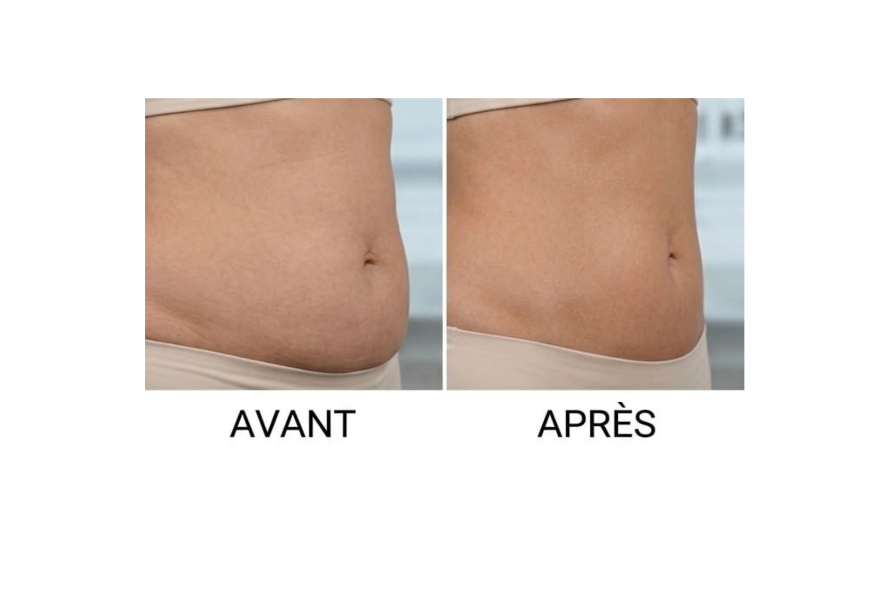 Soin ventre plat / REMODELAGE 
