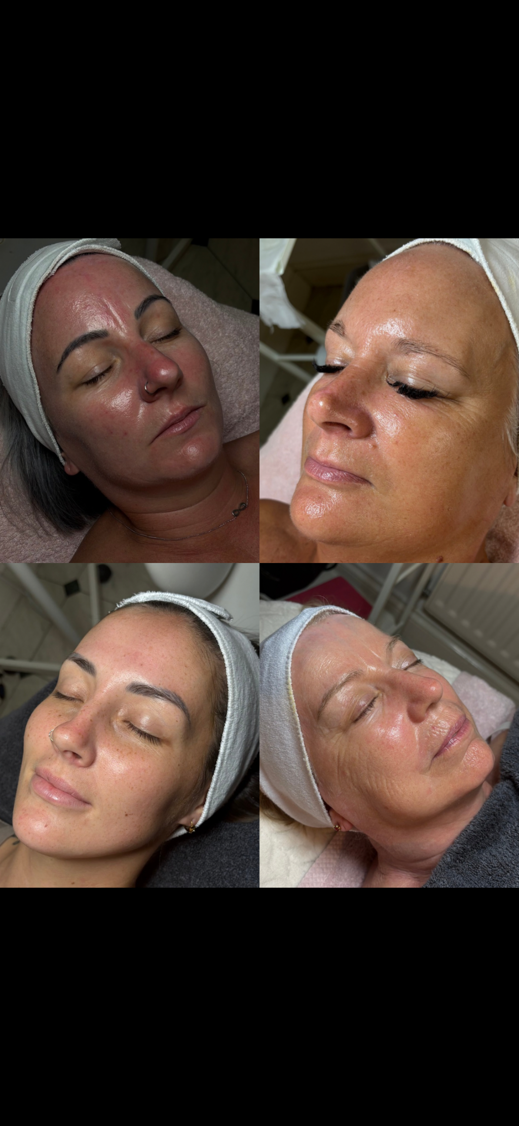 Dermalogica