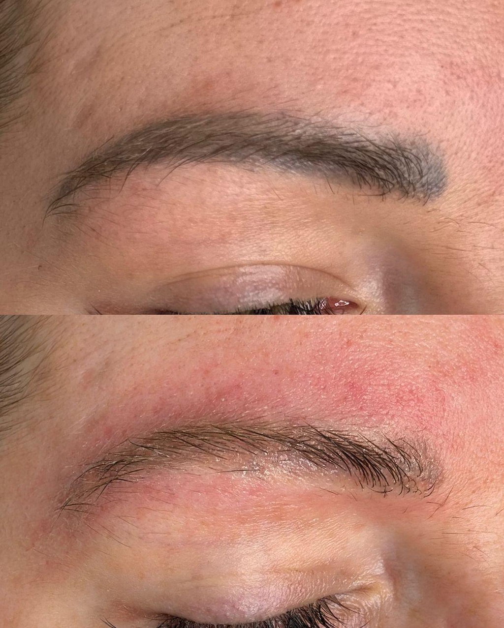 Permanent Make Up / Tattooentfernung Schwalbach am Taunus