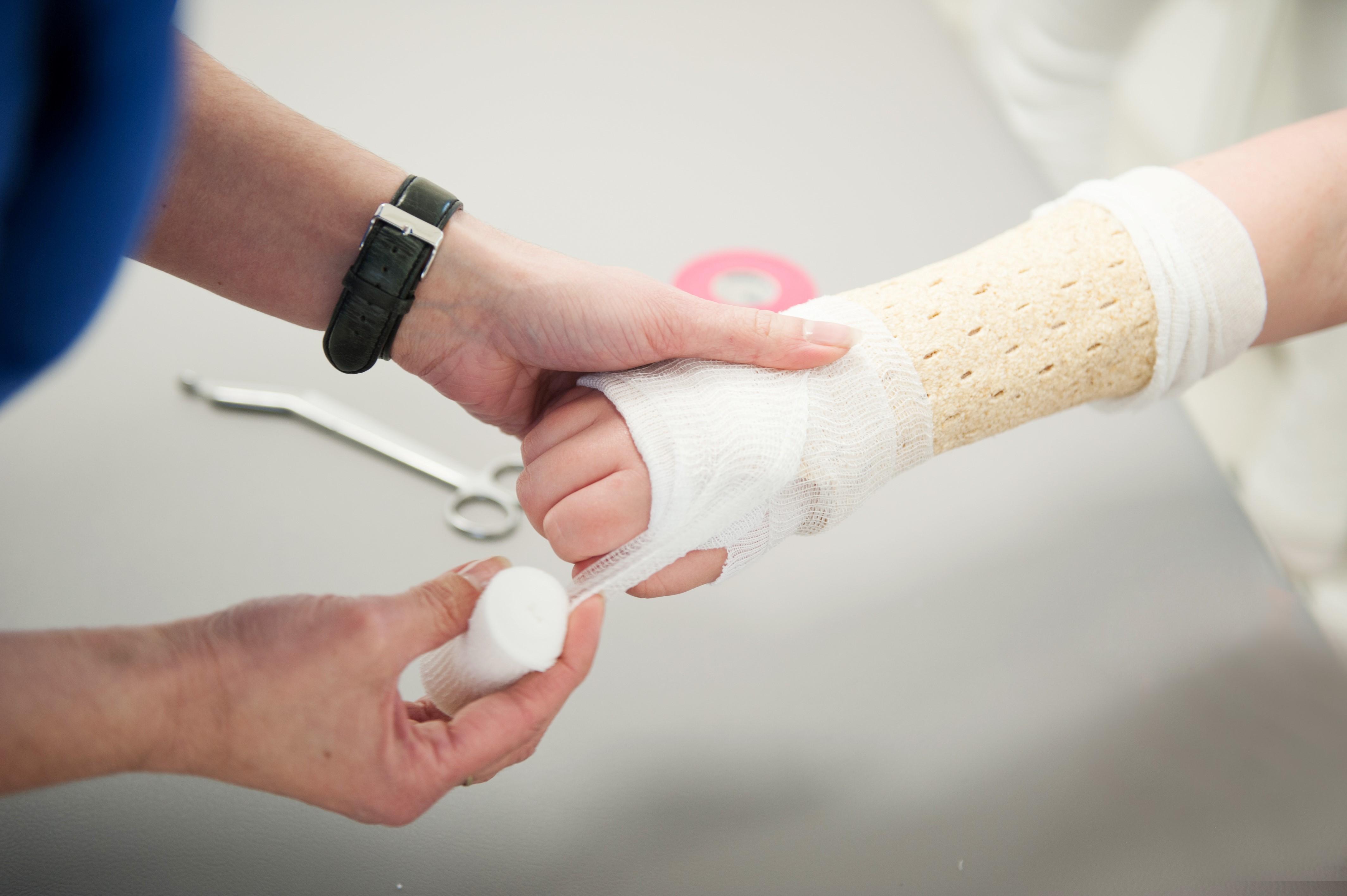 ein Cast wird angewickelt