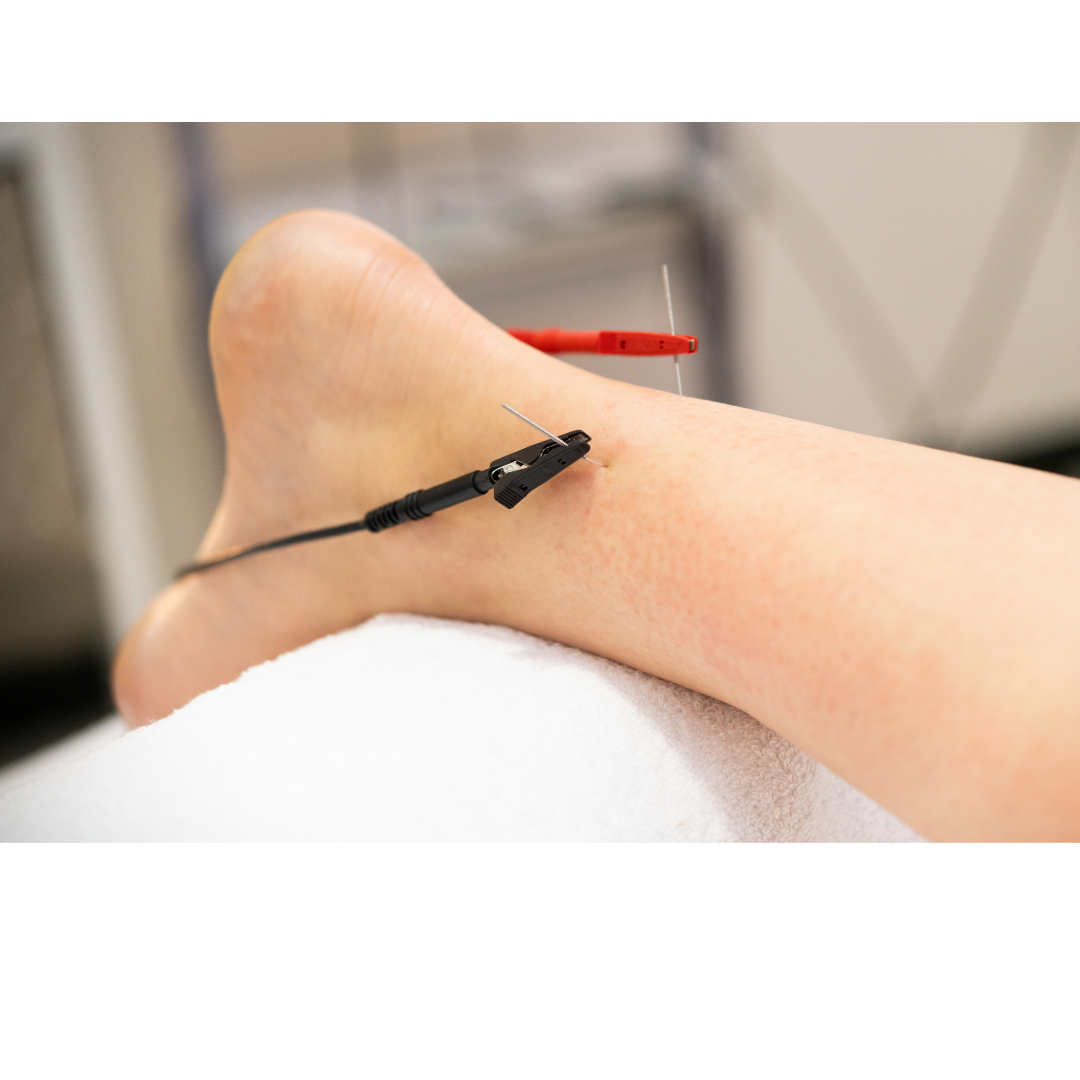 Fisioterapia en lesiones deportivas, tendinitis, fracturas y otros dolores inespecíficos
