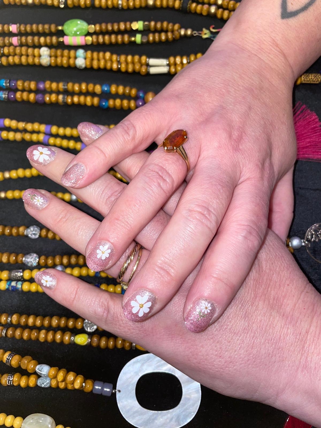 exemple de nail patch posé