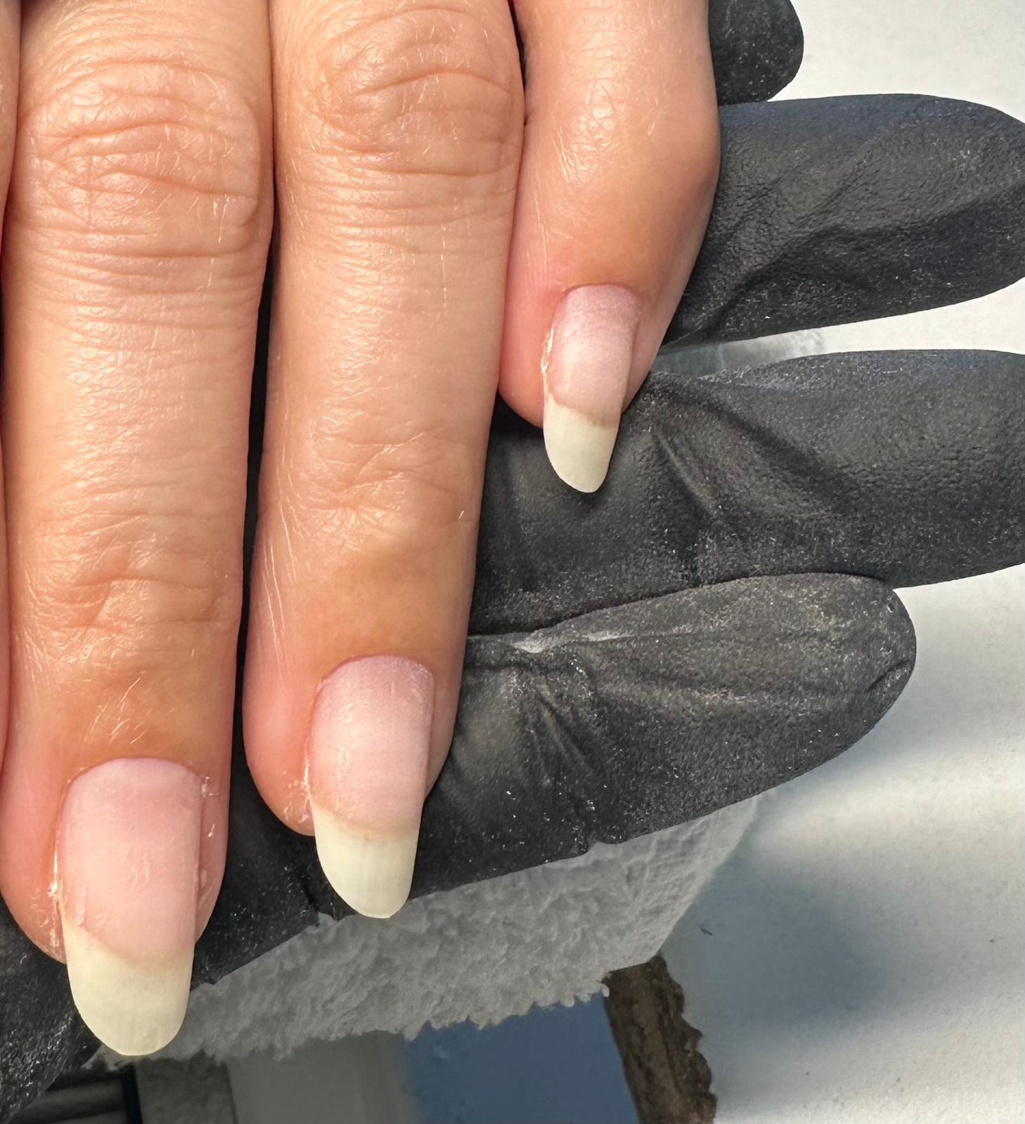 dépose ongle