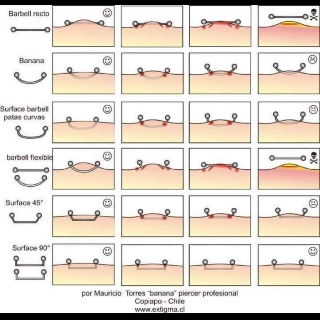 PIERCING DE SURFACE
Pourquoi utiliser ABSOLUMENT
une agrafe a 90° pour un surface ?
Pensez donc à demander à votre perceur quel type de bijou il utilise pour un piercing de surface avant de vous faire percer.
S’il utilise autre chose qu’une agrafe à 90°, fuyez ! Votre piercing risque de faire un rejet assez rapidement et laisser une cicatrice !