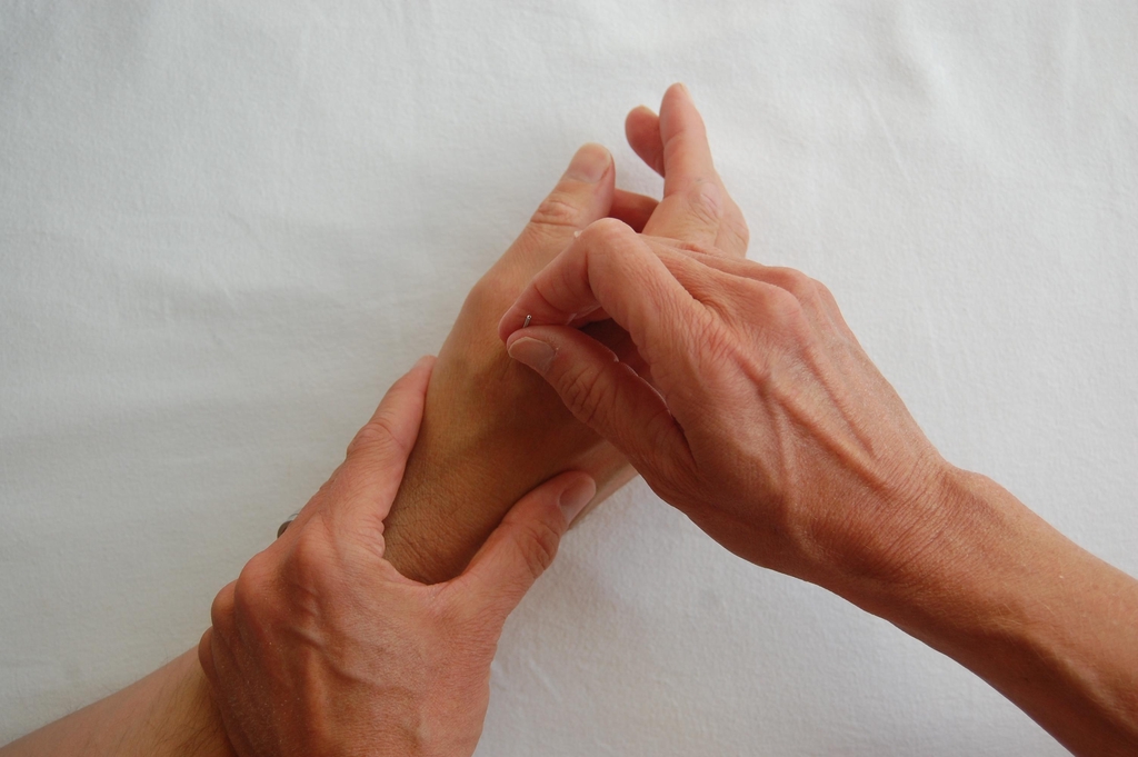 What is acupuncture?