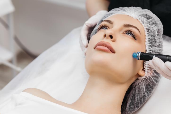 Microneedling - Gesichtsbehandlung für die Dame und den Herren aus Dornach, Basel, Reinach, Arlesheim, Aesch, Duggingen, Muttenz, Münchenstein, Gempen, Hochwald, Riehen, Liestal, Laufen, alle sind Herzlich Willkommen. La Reina GmbH - Beauty & Wellness